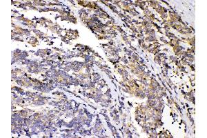 Immunohistochemistry (IHC) image for anti-Protein Kinase, CAMP-Dependent, Regulatory, Type I, alpha (Tissue Specific Extinguisher 1) (PRKAR1A) (AA 2-81) antibody (ABIN5518788)