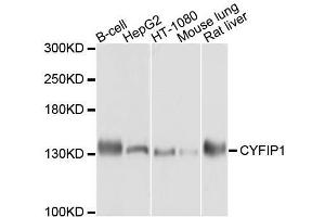 Western blot analysis of extracts of various cell lines, using CYFIP1 antibody. (CYFIP1 抗体  (AA 1-270))