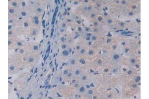 DAB staining on IHC-P; Samples: Human Liver Tissue (APOA5 抗体  (AA 167-335))