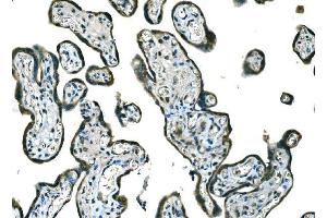 IHC analysis of B Raf/BRAF using anti-B Raf/BRAF antibody (ABIN3043761). (BRAF 抗体  (AA 38-230))