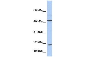 IL9 antibody used at 1 ug/ml to detect target protein. (IL-9 抗体  (Middle Region))