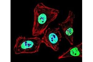 Fluorescent confocal image of HeLa cell stained with HDAC2 antibody at 1:25. (HDAC2 抗体  (AA 410-439))