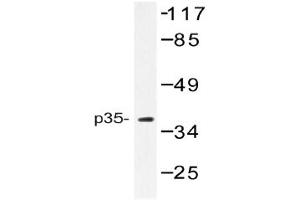 Image no. 1 for anti-Cyclin-Dependent Kinase 5, Regulatory Subunit 1 (p35) (CDK5R1) antibody (ABIN272233) (CDK5R1 抗体)