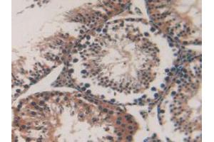 IHC-P analysis of Mouse Testis Tissue, with DAB staining. (MAP1A 抗体  (AA 2552-2759))