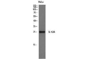 Western Blotting (WB) image for anti-Interleukin 12 alpha (IL12A) (Internal Region) antibody (ABIN3185157) (IL12A 抗体  (Internal Region))