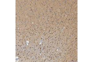 IHC analysis of SNPH using anti-SNPH antibody (ABIN7601724). (Syntaphilin 抗体  (AA 43-482))