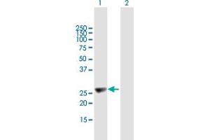 Western Blot analysis of KIFC2 expression in transfected 293T cell line by KIFC2 MaxPab polyclonal antibody. (KIFC2 抗体  (AA 1-226))