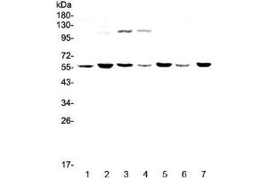 Western blot testing of human 1) HeLa, 2) MDA-MB-453, 3) Jurkat, 4) HepG2, 5) SK-OV-3, 6) PANC-1 and 7) mouse thymus lysate with CHRNA3 antibody at 0. (CHRNA3 抗体)