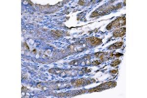 IHC analysis of Tspan-8/Tspan8 using anti-Tspan-8/Tspan8 antibody (ABIN7599681). (Tspan-8 抗体  (AA 108-203))