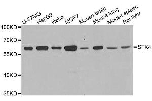 Western blot analysis of extracts of various cell lines, using STK4 antibody. (STK4 抗体  (AA 303-487))