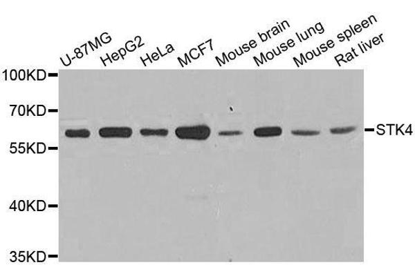STK4 抗体  (AA 303-487)