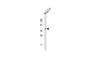 Anti-CCR7 Antibody (Nterm) at 1:500 dilution + MOLT-4 whole cell lysate Lysates/proteins at 20 μg per lane.
