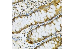 Immunohistochemistry (Paraffin-embedded Sections) (IHC (p)) image for anti-Heat Shock Protein 90kDa alpha (Cytosolic), Class B Member 1 (HSP90AB1) (AA 1-300) antibody (ABIN3021406)