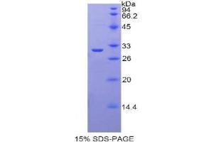 SDS-PAGE analysis of Rat Lactoperoxidase Protein. (LPO 蛋白)