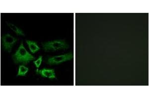 Immunofluorescence analysis of A549 cells, using NT5C1A Antibody. (NT5C1A 抗体  (AA 151-200))