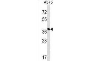 Western Blotting (WB) image for anti-DPH1 Homolog (DPH1) antibody (ABIN2998833) (DPH1 抗体)