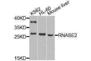 Western blot analysis of extracts of various cell lines, using RNASE2 antibody (ABIN6003657) at 1/1000 dilution. (RNASE2 抗体)