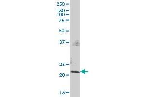 PMVK MaxPab polyclonal antibody. (PMVK 抗体  (AA 1-192))