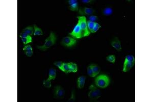 Immunofluorescence staining of MCF-7 cells with ABIN7156430 at 1:200, counter-stained with DAPI. (ITGA2 抗体  (AA 188-365))