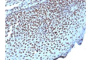 Immunohistochemistry (IHC) image for anti-Histone H1 antibody (ABIN6939594)