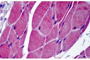 Human Skeletal Muscle: Formalin-Fixed, Paraffin-Embedded (FFPE) (TRPC3 抗体  (C-Term))