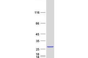 Western Blotting (WB) image for ADP Ribosylation Factor Like GTPase 6 (ARL6) (Transcript Variant 2) protein (Myc-DYKDDDDK Tag) (ABIN2714915)