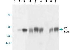 Western blot analysis of GNRHR monoclonal antibody, clone AT2. (GNRHR 抗体)