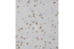 D staining MeCP2 in mouse brain tissue sections by Immunohistochemistry (IHC-P - paraformaldehyde-fixed, paraffin-embedded sections). (MECP2 抗体  (AA 400-428))