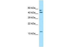 WB Suggested Anti-MRPL41 Antibody Titration: 1.