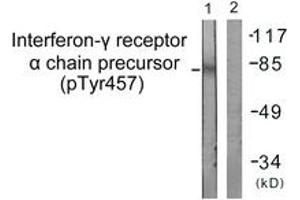 Western blot analysis of extracts from COS7 cells, using Interferon-gamma Receptor alpha (Phospho-Tyr457) Antibody. (IFNGR1 抗体  (pTyr457))