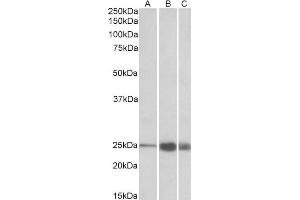 ABIN1590144 (1 µg/mL) staining of Human (A), Mouse(B) and Rat (C) Skeletal Muscle lysate (35 µg protein in RIPA buffer). (TNNI2 抗体  (AA 83-95))