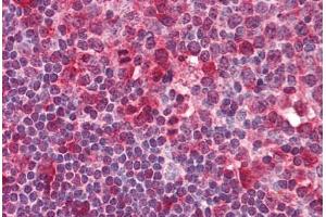 Human Tonsil (formalin-fixed, paraffin-embedded) stained with SYK antibody ABIN239825 at 5 ug/ml followed by biotinylated anti-mouse IgG secondary antibody ABIN481714, alkaline phosphatase-streptavidin and chromogen. (SYK 抗体  (AA 5-360))