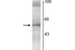 Western blot of rat hippocampal lysate showing specific immunolabeling of the ~58 kDa TR-α2 protein. (THRA 抗体  (C-Term))