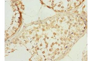 Immunohistochemistry of paraffin-embedded human testis tissue using ABIN7146273 at dilution of 1:100 (Calcineurin B 抗体  (AA 1-170))