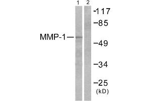 Western blot analysis of extracts from HepG2 cells, using MMP-1 antibody (ABIN5976455). (MMP1 抗体  (C-Term))