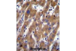UBAP2 Antibody (N-term) immunohistochemistry analysis in formalin fixed and paraffin embedded human liver tissue followed by peroxidase conjugation of the secondary antibody and DAB staining. (UBAP2 抗体  (N-Term))