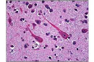 Immunohistochemistry (IHC) image for anti-Proprotein Convertase Subtilisin/kexin Type 1 (PCSK1) (AA 652-754) antibody (ABIN781869)