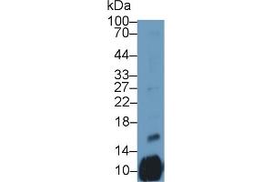 Detection of PF4V1 in Human Placenta lysate using Polyclonal Antibody to Platelet Factor 4 Variant 1 (PF4V1)