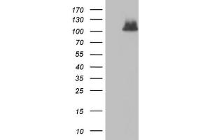 Western Blotting (WB) image for anti-ADAM Metallopeptidase with Thrombospondin Type 1 Motif, 1 (ADAMTS1) (AA 412-644) antibody (ABIN2715717) (ADAMTS1 抗体  (AA 412-644))