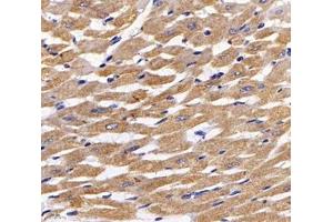 Immunofluorescent analysis of paraformaldehyde-fixed rat heart using,MYBPC3 (ABIN7074729) at dilution of 1: 2000 (MYBPC3 抗体)