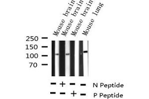 Western blot analysis of Phospho-B-RAF (Ser446) expression in various lysates (BRAF 抗体  (pSer446))