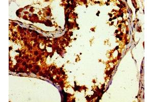 Immunohistochemistry of paraffin-embedded human testis tissue using ABIN7165242 at dilution of 1:100 (DBF4 抗体  (AA 101-281))