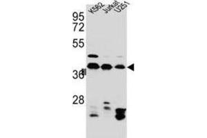 Western Blotting (WB) image for anti-Heterogeneous Nuclear Ribonucleoprotein C (C1/C2) (HNRNPC) antibody (ABIN2995806) (HNRNPC 抗体)