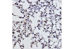 Immunohistochemistry of paraffin-embedded mouse lung using Acetyl-Histone H3-K27 Rabbit mAb (ABIN3016650, ABIN3016651, ABIN3016652, ABIN1682513 and ABIN1682514) at dilution of 1:100 (40x lens). (Histone 3 抗体  (acLys27))