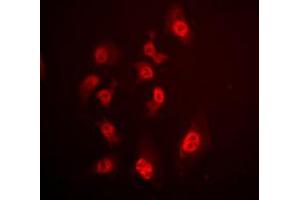 Immunofluorescent analysis of SMAD4 staining in HeLa cells. (SMAD4 抗体  (N-Term))