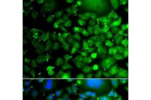 Immunofluorescence analysis of A549 cells using MOCS3 Polyclonal Antibody (MOCS3 抗体)