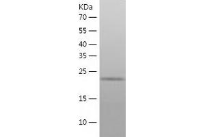 Western Blotting (WB) image for Fibroblast Growth Factor 23 (FGF23) (AA 25-251) protein (His tag) (ABIN7122938) (FGF23 Protein (AA 25-251) (His tag))