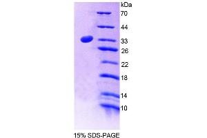 SDS-PAGE (SDS) image for Protein tyrosine Phosphatase, Non-Receptor Type 2 (PTPN2) (AA 1-257) protein (His tag) (ABIN4989861) (PTPN2 Protein (AA 1-257) (His tag))