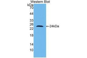 Western blot analysis of recombinant Human IL10. (IL-10 抗体  (AA 1-178))