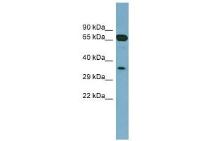 GLOD4 antibody used at 1 ug/ml to detect target protein. (GLOD4 抗体  (Middle Region))